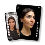 rhinoplasty simulator