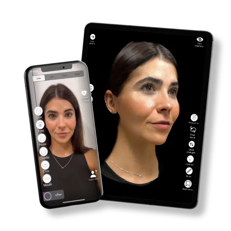 simulador de rinoplastia