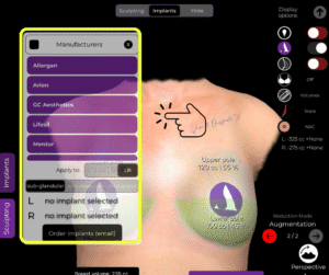 Wählen Sie das gewünschte Implantat aus dem Implantatkatalog im Brustimplantat-Koffer in der Arbrea Suite