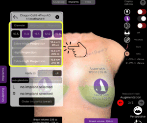 Wählen Sie die Merkmale des Implantats aus dem Implantatkatalog im Brustimplantat-Koffer in der Arbrea Suite
