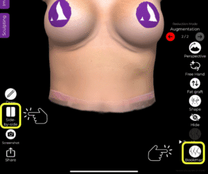 Scelta del confronto fianco a fianco o di tutte le simulazioni nel caso di sostituzione della protesi mammaria nella suite Arbrea