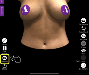 Usando o botão de captura de tela diretamente do Arbrea Suite