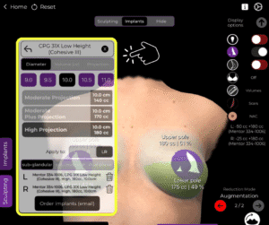 Scegliere la protesi giusta nel catalogo delle protesi per il seno tuberoso in Arbrea Suite