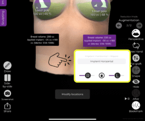 Regolazione con lo strumento forma per il seno tuberoso in Arbrea Suite