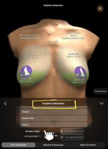 Catálogo de implantes