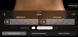 Scars tool