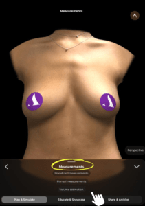 Come calcolare il volume in Arbrea Breast