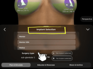How to Adjust Breast Volume in Reduction Mode in Arbrea Suite