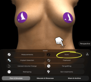 How to Access the Scars Tool in Arbrea Suite