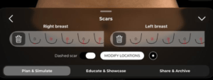 How to Adjust the Nipple Position in Arbrea Suite