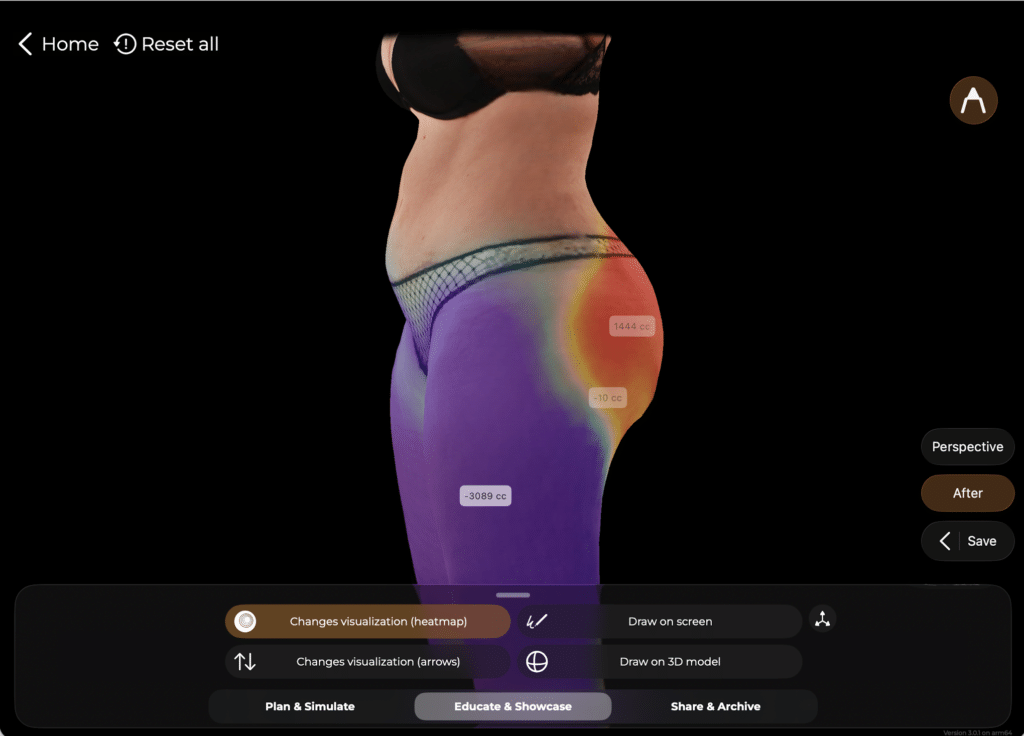 GLP-1 Plastic Surgery Trends: What the 2025 Data Shows