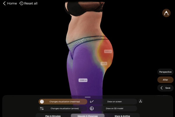 GLP-1 Plastic Surgery Trends: What the 2025 Data Shows