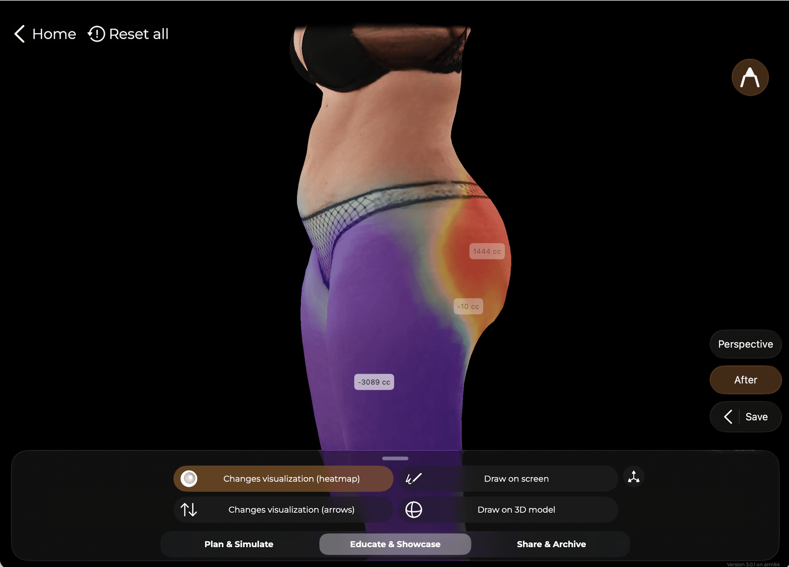 GLP-1 Plastic Surgery Trends: What the 2025 Data Shows